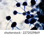Small photo of Microscope of black fungus spore strain with Lactophenol cotton blue, molds or yeasts with macro 40x lens, contamination in air room, pollution aerosol environmental. Microbiology laboratory concepts.