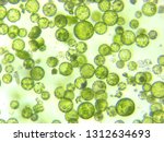 Small photo of A photomicrograph of a plant protoplast cell isolated for use in a recent cutting-edge biotechnology CRISPR technology experiment.