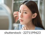 Small photo of Sensitive skin with cosmetology, Asian young woman looking at red spot on her face from cosmetic allergy in the mirror.