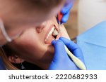 Small photo of Dentist checks teeth in clinic. Prevention of the oral cavity of a girl at the dentist. Close-up