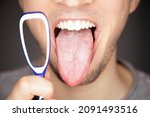 white covered and coated tongue out with tiny bumps is indicator for sickness and infections and reason for bad breath and smell but can be cleaned by tongue coating cleaner by scraping the white foam