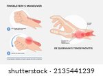 de quervain's pain tendon thumb ... | Shutterstock .eps vector #2135441239