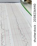 Small photo of Non stress test paper, medical care for monitoring fetal heart rate and maternal uterine contractions in labor room that showing fetal heart rate variability and uterine contractions few times.
