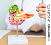 Small photo of Doctor with human Pancreatitis anatomy model with Pancreas, Gallbladder, Bile Duct, Duodenum, Small intestine and tablet. Pancreatic cancer, acute pancreatitis and Digestive system