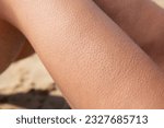 Goosebumps on the legs of a young woman sitting on the beach. Contrasting air and sun baths. Close-up.