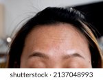 Small photo of eyebrows go up, causing lines to appear across the forehead, woman quirk up, wrinkle on forehead, beauty concept