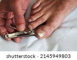 Nail care cutting toenail with fungus disease problem, fungus infects the areas between toes and the skin of the feet, it