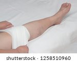 Small photo of Treatment of bursitis of the knee joint with a medical compress, close-up, medical, synovitis and orthopaedy