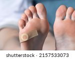 Small photo of Woman's foot with glued medical plaster for plantar wart. Treatment of calluses and warts on the feet, dermatological