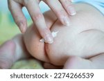 The mother applies a healing cream to the baby's red bottom. Healing ointment for diaper rash, irritation and redness on the delicate skin of a baby.