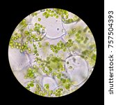 Small photo of Microscopic photo of cells with chloroplasts in parenchyma of a leaf.