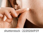 Small photo of Woman using acne patches for treatment of pimple and rosacea close-up. Facial rejuvenation cleansing cosmetology. Girl with acne stick round acne patch on her cheek