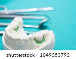 implan model tooth support fix... | Shutterstock . vector #1049353793