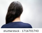 Small photo of The woman is a brunette with her hair pulled back to one side, and her shoulders are bare, where dandruff is noticeable. Rear view. White background. The concept of dandruff and pediculosis.