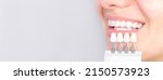 Small photo of Banner tooth whitening, perfect white crown teeth close up with shade guide bleach color, female veneer smile, dental care and stomatology, dentistry, copyspace.