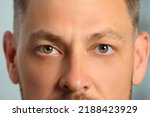 Man with beautiful eyes of different colors, closeup. Heterochromia iridis