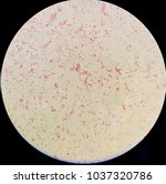 Small photo of gram negative pleomorphic bacilli