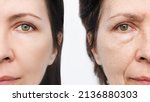 Small photo of Comparison of the face of young and aged women. Youth, old age. The process of aging and rejuvenation, the result years later. Beauty treatments and lifting. Age-related changes,appearance of wrinkles