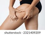 Small photo of Cropped shot of a young tanned woman in black panties grabbing skin on her thigh with excess fat and cellulite isolated on a white background. Excess weight, overweight. Flabby sagging skin