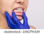 Small photo of Gum inflammation. Young woman's face with doctor's hand in a blue glove on the jaw showing red bleeding painful gums isolated on gray background. Examination at the dentist. Dentistry, dental care