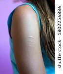 Small photo of Young womans arm with scars from self mutilation ,on plain background self harm . room for text.