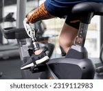 Small photo of Asian woman with prosthetic leg cycling in gym. Young girl with foot prosthesis physical exercise in fitness. Artificial limb equipment help accident survivor or amputee people to mobility. Copy space
