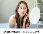 Young woman asian are worried about faces Dermatology and allergic to steroids in cosmetics. sensitive skin,red face from sunburn, acne,allergic to chemicals,rash on face. skin problems and beauty