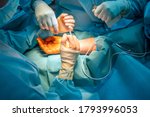Small photo of two doctors operate on a wrist fracture in an operating theatre