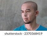 Small photo of Thai bald man grow a beard acne blemishes on loft wall background