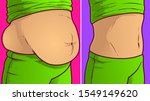 belly fat  before after. vector ...
