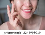Small photo of Cropped shot of Asian woman applying cream on her face for treating redness skin. Cause of redness maybe occur from allergy to skincare ingredients, heat, sun exposure, alcohol, acne etc.