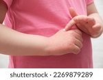Small photo of The child scratches atopic skin. Dermatitis, diathesis, allergy on the child's body.irritation and pruritus.