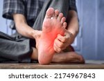 Small photo of Itchy foot skin of Asian elder man. Concept of skin diseases such as scabies, fungal infection, allergy, etc.