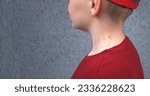 Small photo of Manifestations of diathesis on the boy's neck, atopic dermatitis, childhood illness, medicine, close-up, side view, copyspace, gray blurred background, dermatology, itching, unrecognizable, treatment