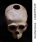 Small photo of a scull with lobotomy