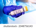 New infectious Eris variant of covid disease (EG.5) sample in lab tube in the scientist hand in blue medical glove on light background