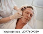 Small photo of Cosmetologist drawing guidelines for injection of cosmetic product with white pencil. Thread facelift with arrows for male skin, facial contouring procedure with meso threads for facial rejuvenation