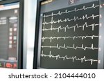 Small photo of the screen monitoring show electrocardiography waveform in critical care unit