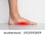 Foot pain because of strong flat feet also called pes planus or fallen arches. The arches on the inside of feet are flattened