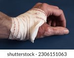 Small photo of A close-up of a partially spiral bandaged hand resting on a blue table exposing remnants of a second-degree burn in the thumb area. First aid and wound healing.