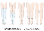 legs there is edema  no... | Shutterstock .eps vector #276787223