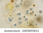 Small photo of Yeast and Mould Test. biodiversity. Microbiology. Colony morphology of Yeast and mould. Fungal colony morphology. Fungal growth in DG18.