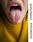 Small photo of open mouth with tongue. plaque on the tongue with cracks. diseases on the tongue.