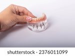 Small photo of render of mandibular prosthesis all on 4 system supported by implants over white background