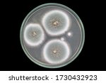Small photo of Culture of Aspergillus fumigatus fungus on Sabouraud Dextrose Agar (SDA) with black background from top view