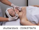 Small photo of young woman lying on a stretcher in an aesthetic center performing beauty treatment and facial aesthetics with dermapen and dermaplaning techniques
