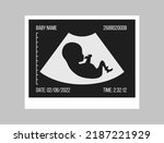 pregnancy ultrasound black and...