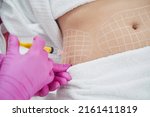Dermatologist performing non invasive fat reduction procedure in beauty center