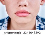 Small photo of Chapped lips of preteen schoolboy from dry weather on sea resort. Schoolboy with chapped rose lips sitting on hot sea beach closeup