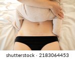 Small photo of Mom's abdomen after cesarean section. Scar seam. A young mother holds the baby in her arms. Real motherhood. Lifestyle. High quality photo